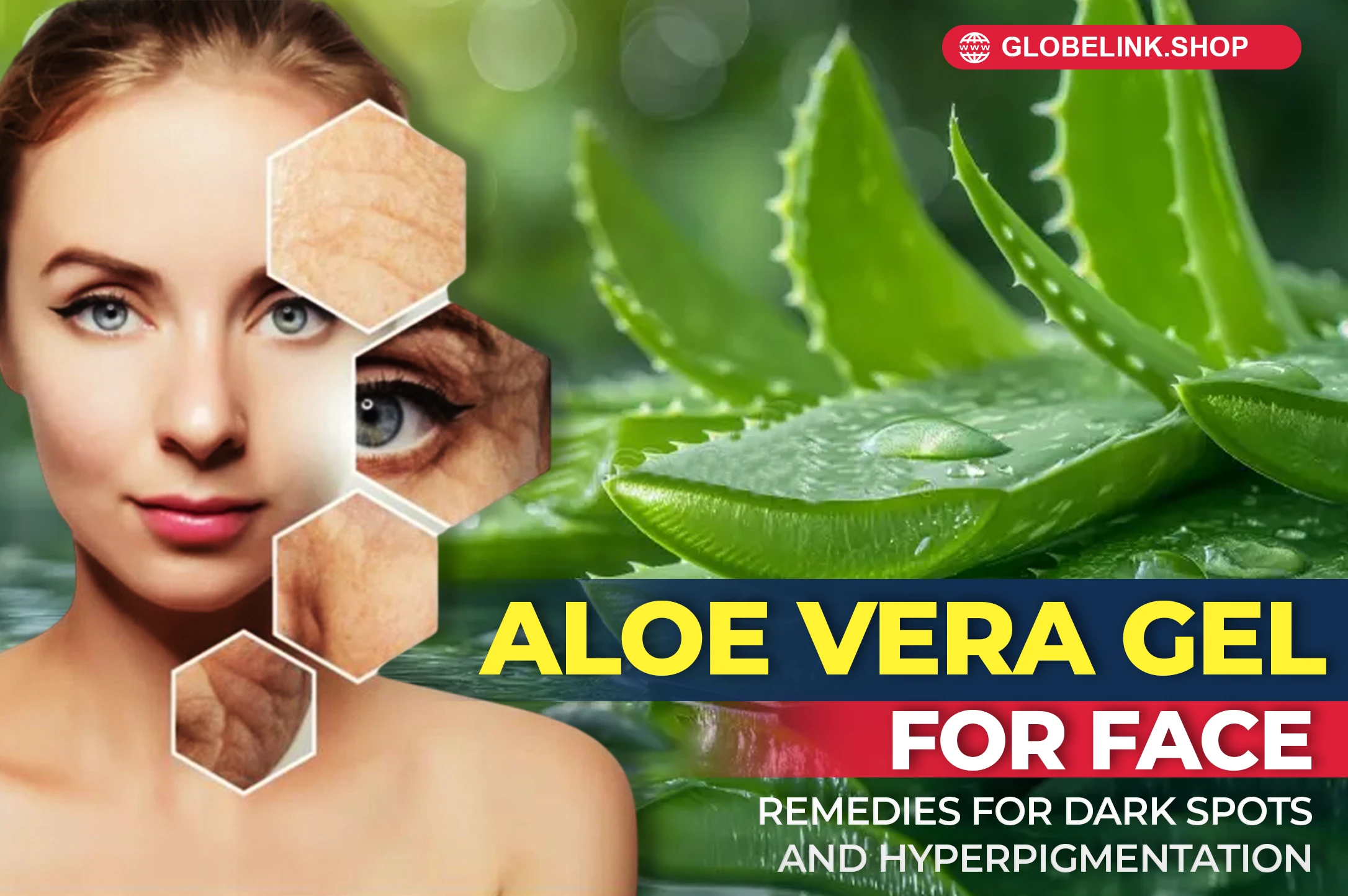 Aloe Vera Gel for Face: Remedies for Dark Spots and Hyperpigmentation